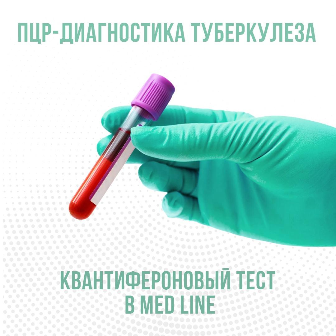 В Med Line теперь можно сдать Квантифероновый тест! - Med Line - семейная  клиника г. Белгород